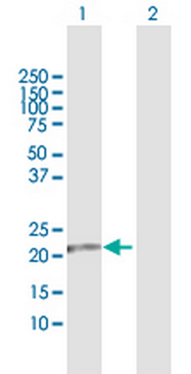 FKBP11 Antibody in Western Blot (WB)