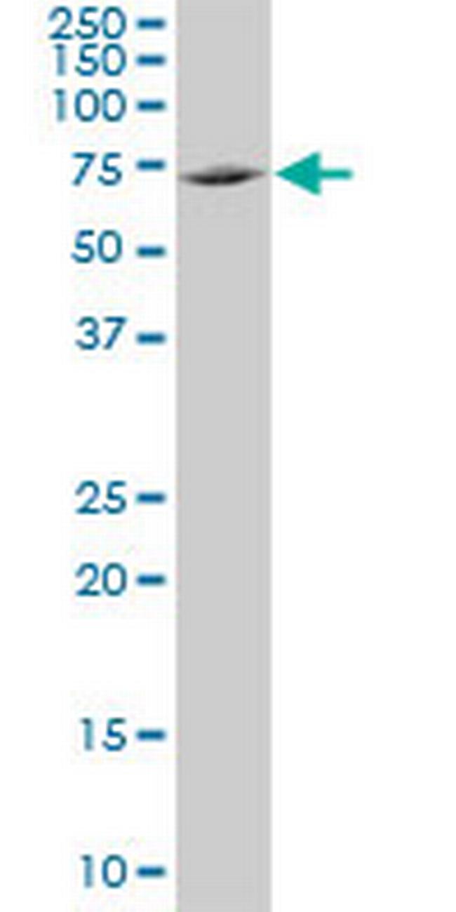 TXNDC3 Antibody in Western Blot (WB)