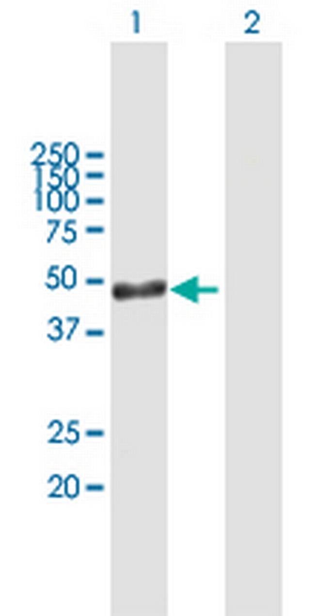 ARL6IP4 Antibody in Western Blot (WB)