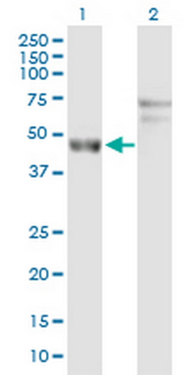 ARL6IP4 Antibody in Western Blot (WB)