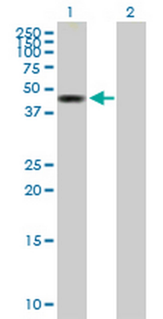 ZMYND10 Antibody in Western Blot (WB)