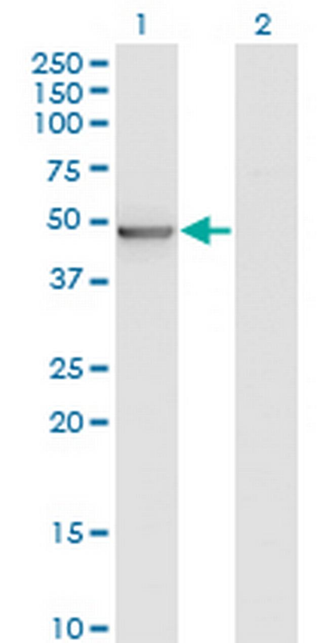 ZMYND10 Antibody in Western Blot (WB)