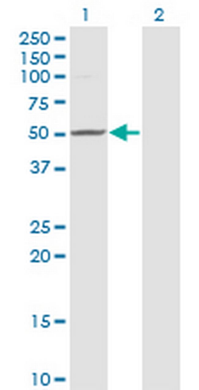 ZMYND10 Antibody in Western Blot (WB)