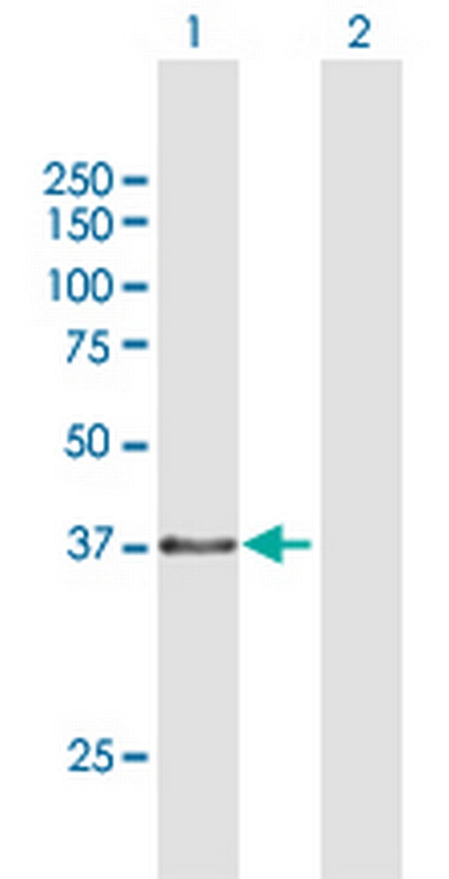 TEX264 Antibody in Western Blot (WB)