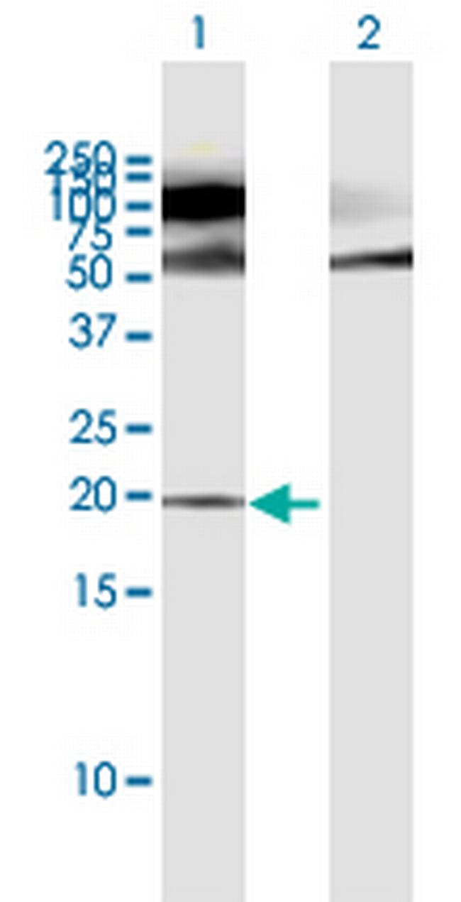POMP Antibody in Western Blot (WB)