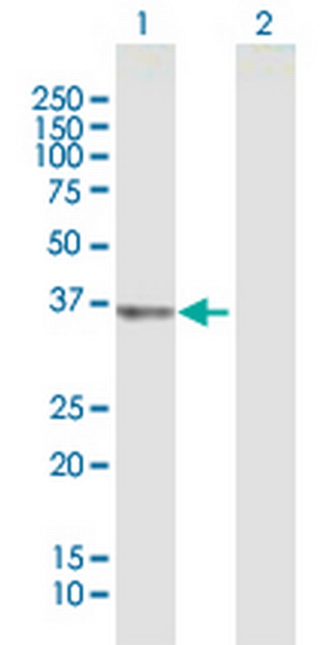 UCHL5 Antibody in Western Blot (WB)