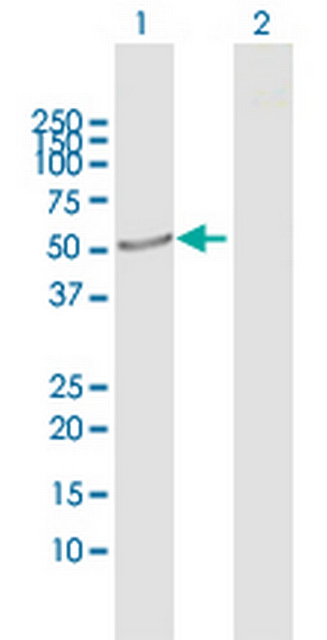 CRLF3 Antibody in Western Blot (WB)