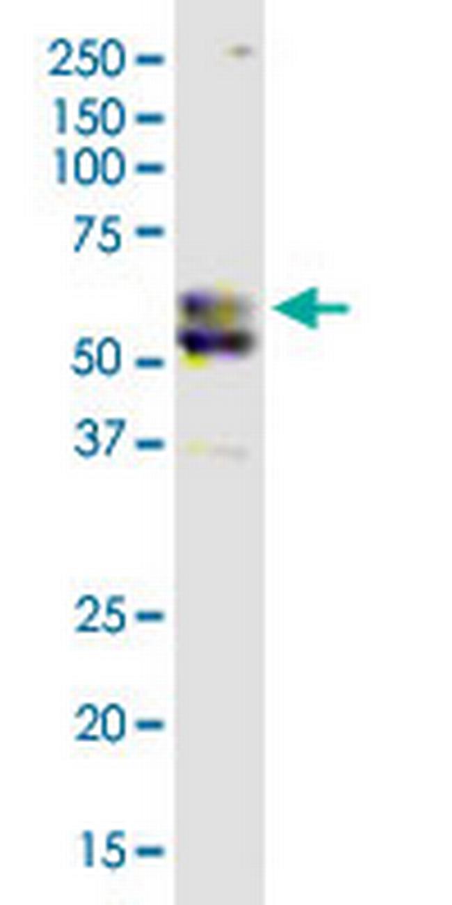 CSAD Antibody in Western Blot (WB)