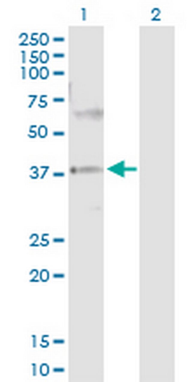 PRKAG2 Antibody in Western Blot (WB)