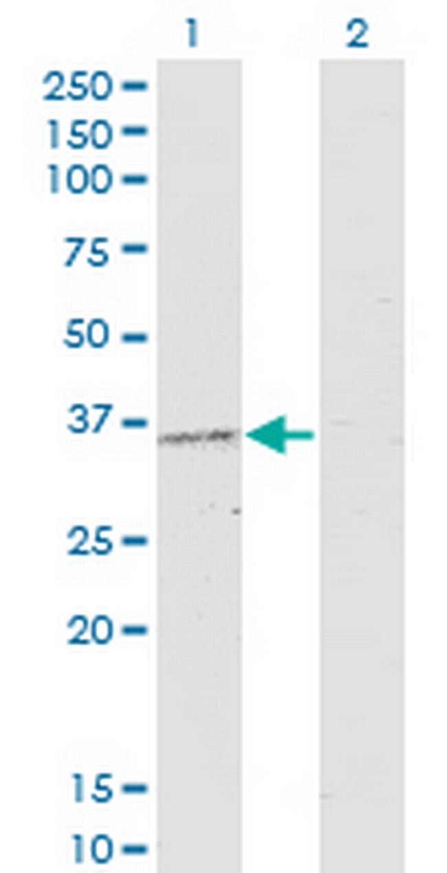PRKAG2 Antibody in Western Blot (WB)