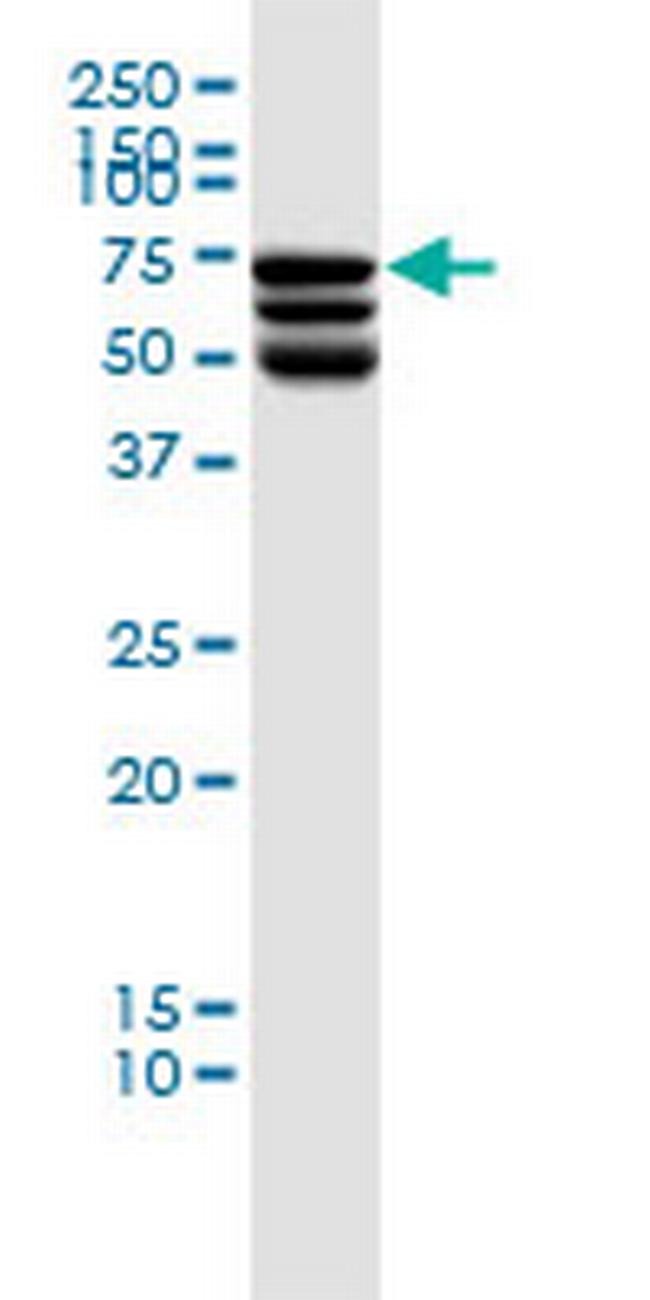 DDX41 Antibody in Western Blot (WB)