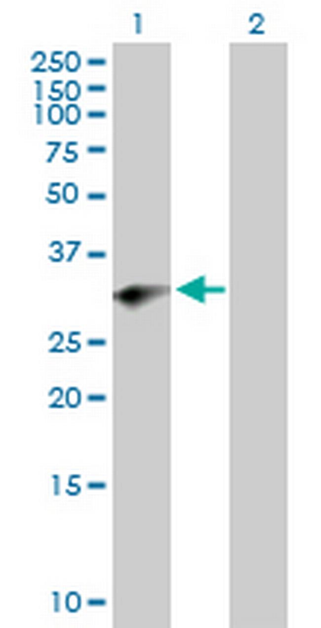 PRRX2 Antibody in Western Blot (WB)