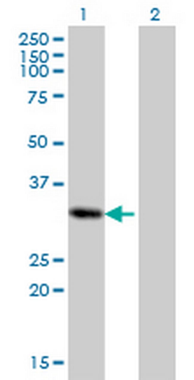 PRRX2 Antibody in Western Blot (WB)