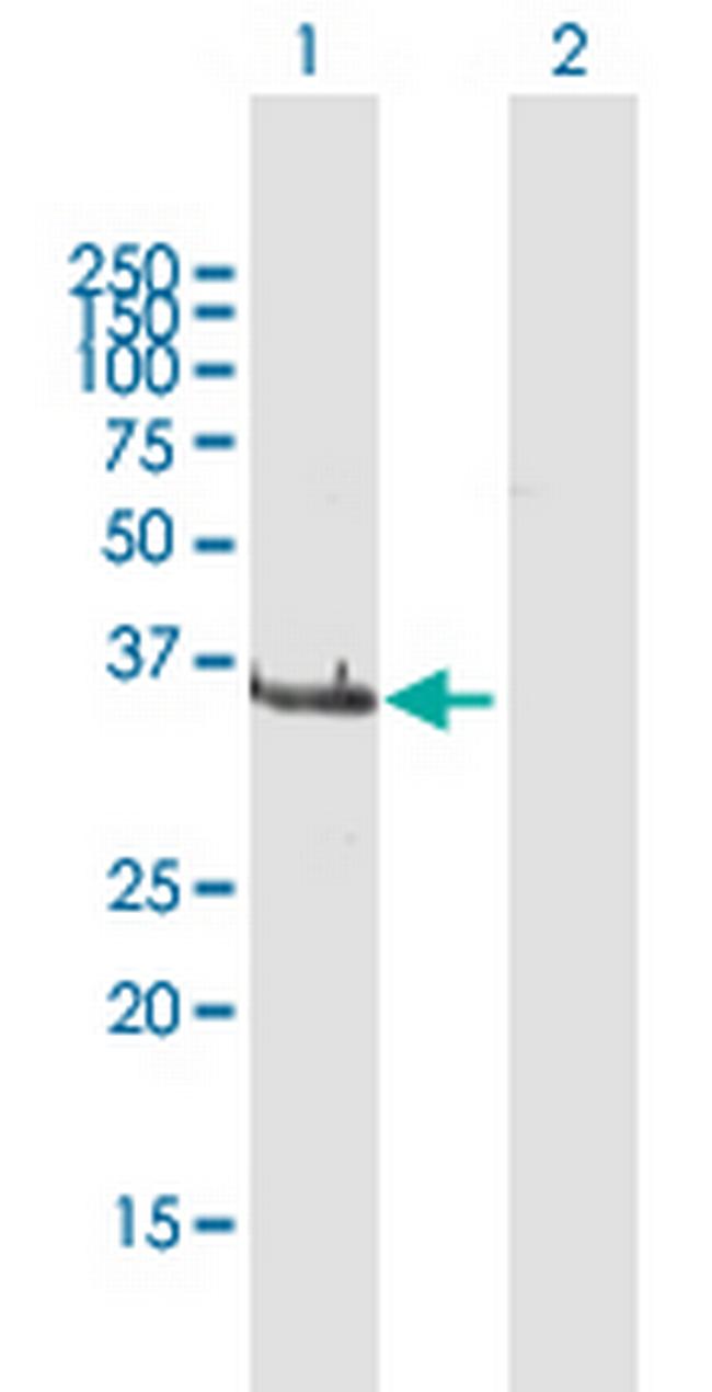 LCMT1 Antibody in Western Blot (WB)
