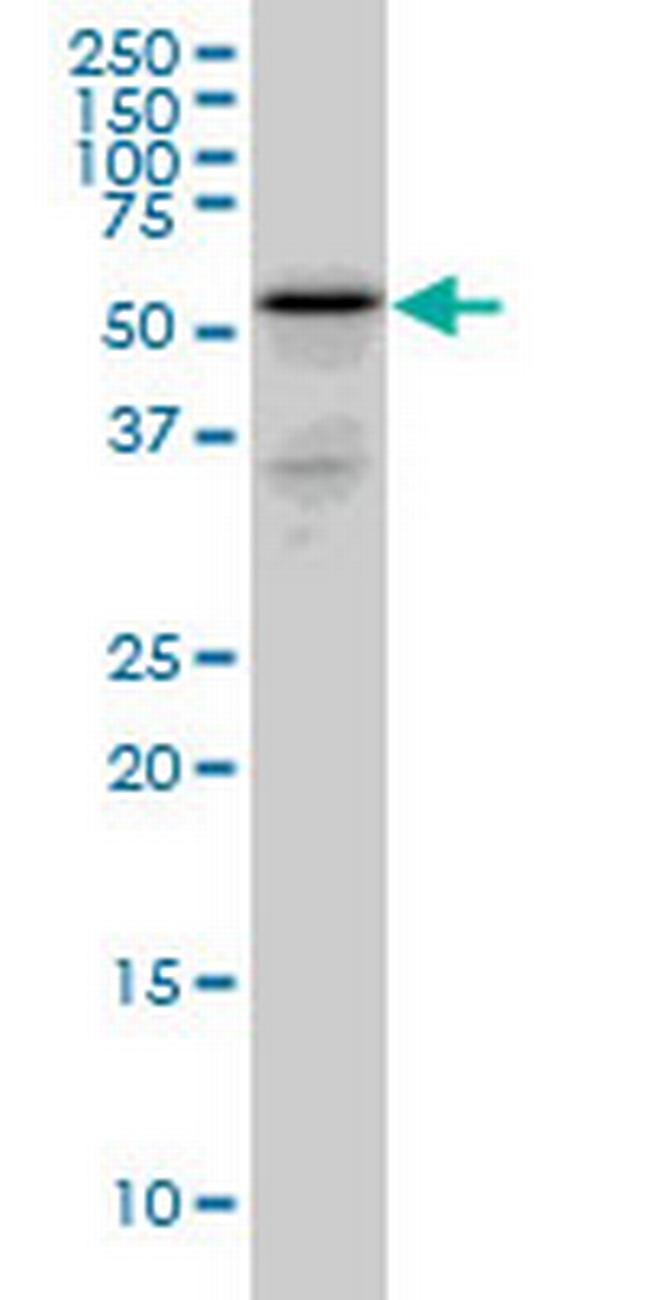 RHCG Antibody in Western Blot (WB)