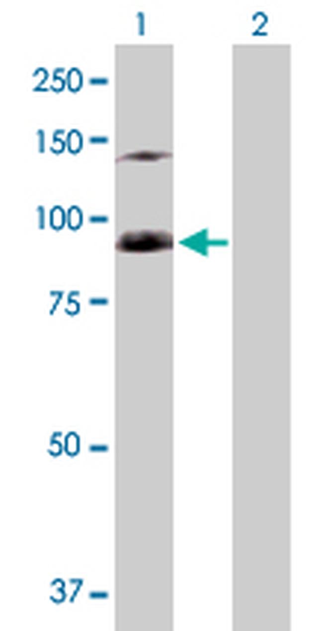 SFMBT1 Antibody in Western Blot (WB)
