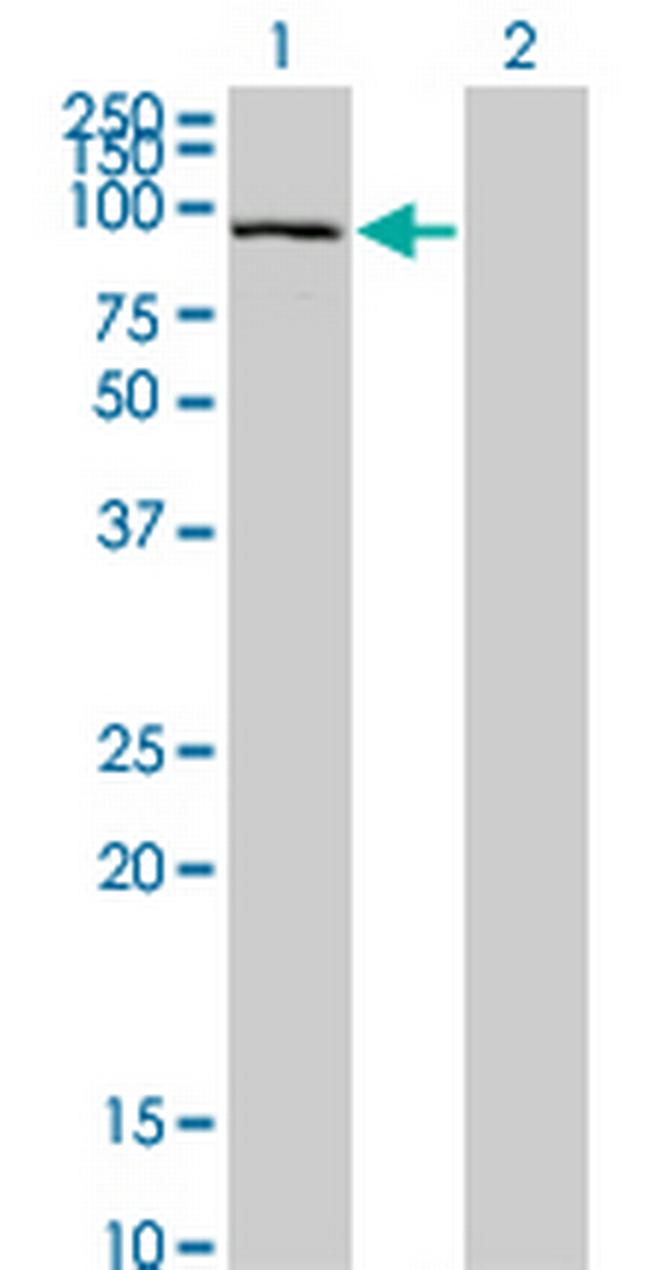 SFMBT1 Antibody in Western Blot (WB)