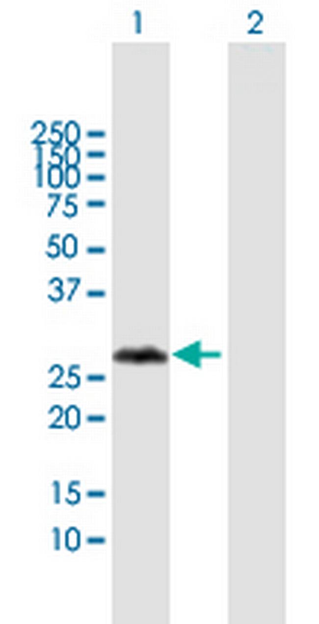 VCX3A Antibody in Western Blot (WB)