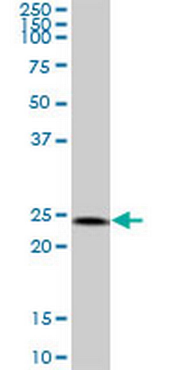 HSPC111 Antibody in Western Blot (WB)