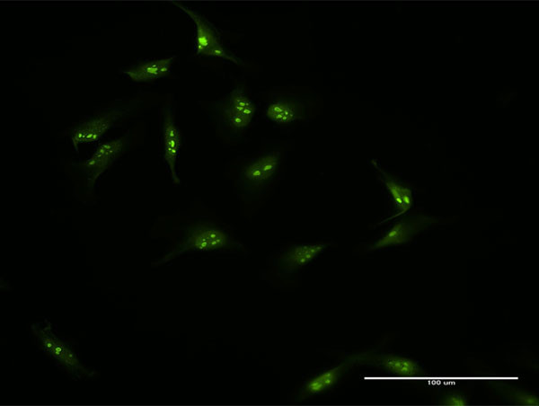 HSPC111 Antibody in Immunocytochemistry (ICC/IF)