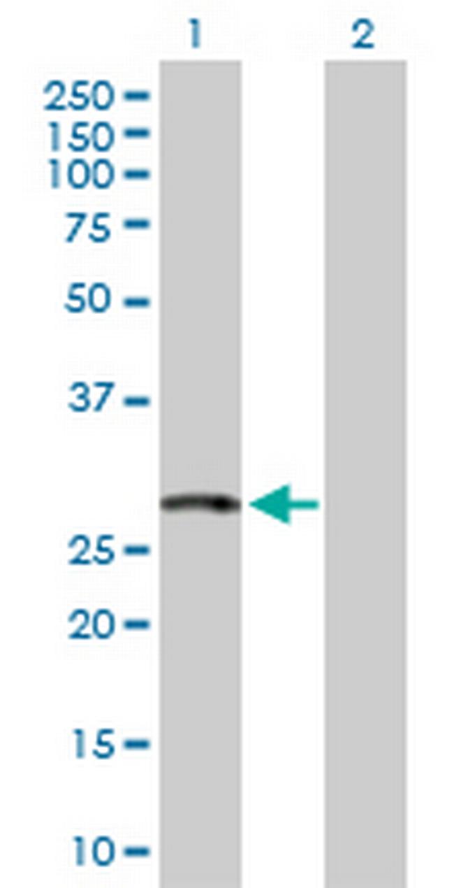 HSPC111 Antibody in Western Blot (WB)