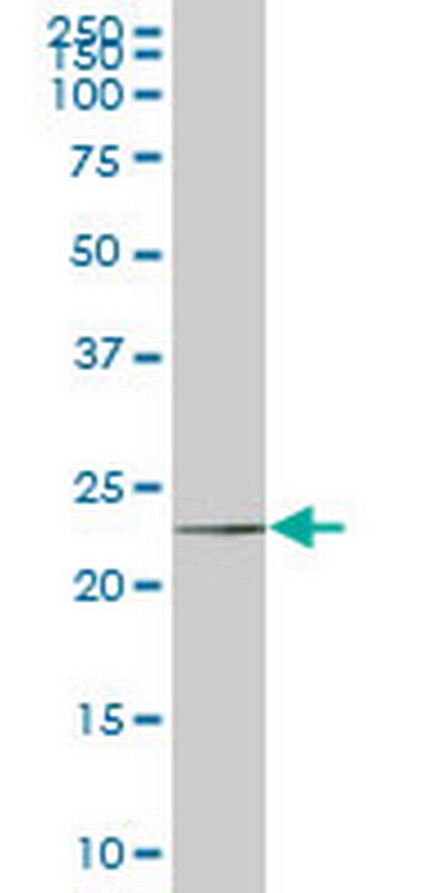 HSPC111 Antibody in Western Blot (WB)