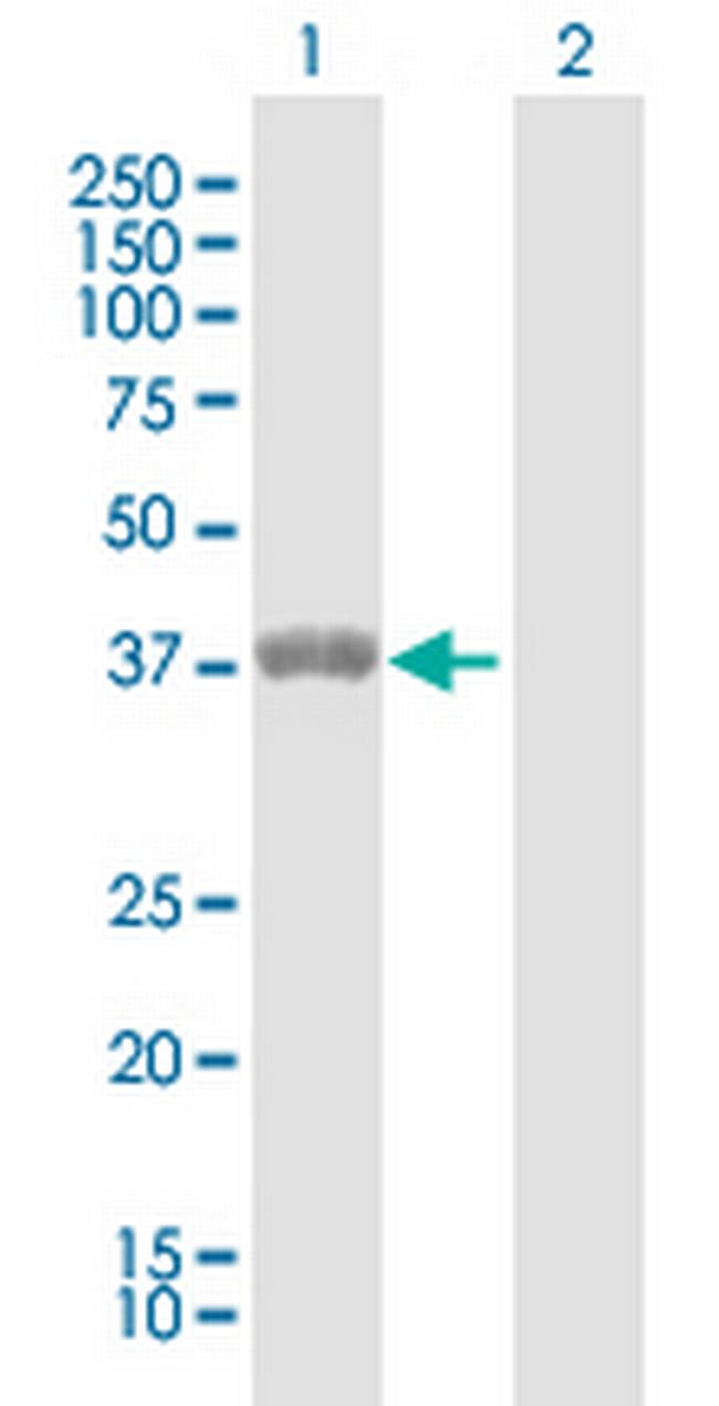 ETV7 Antibody in Western Blot (WB)