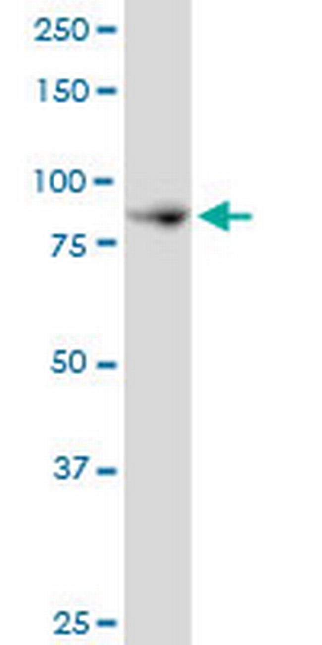 NCKIPSD Antibody in Western Blot (WB)