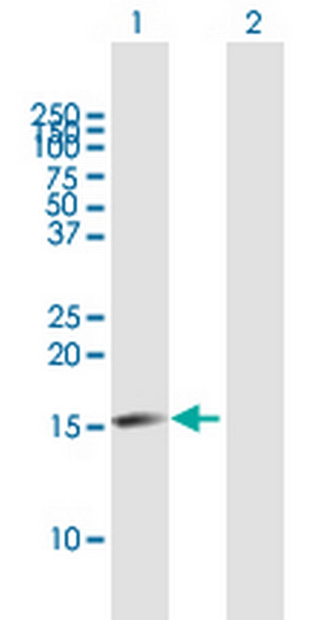 C14orf129 Antibody in Western Blot (WB)