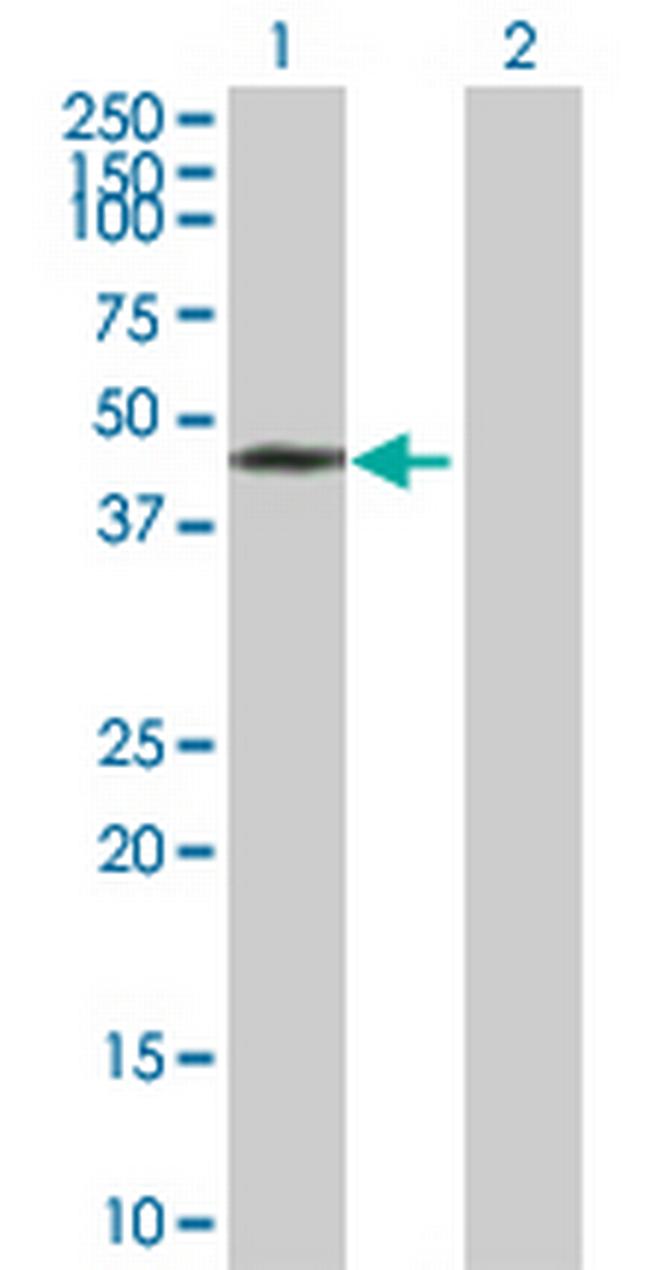 PHF7 Antibody in Western Blot (WB)