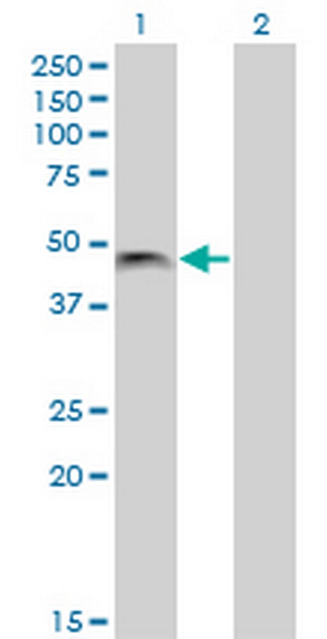 PHF7 Antibody in Western Blot (WB)
