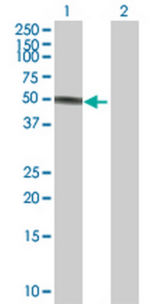 PPHLN1 Antibody in Western Blot (WB)