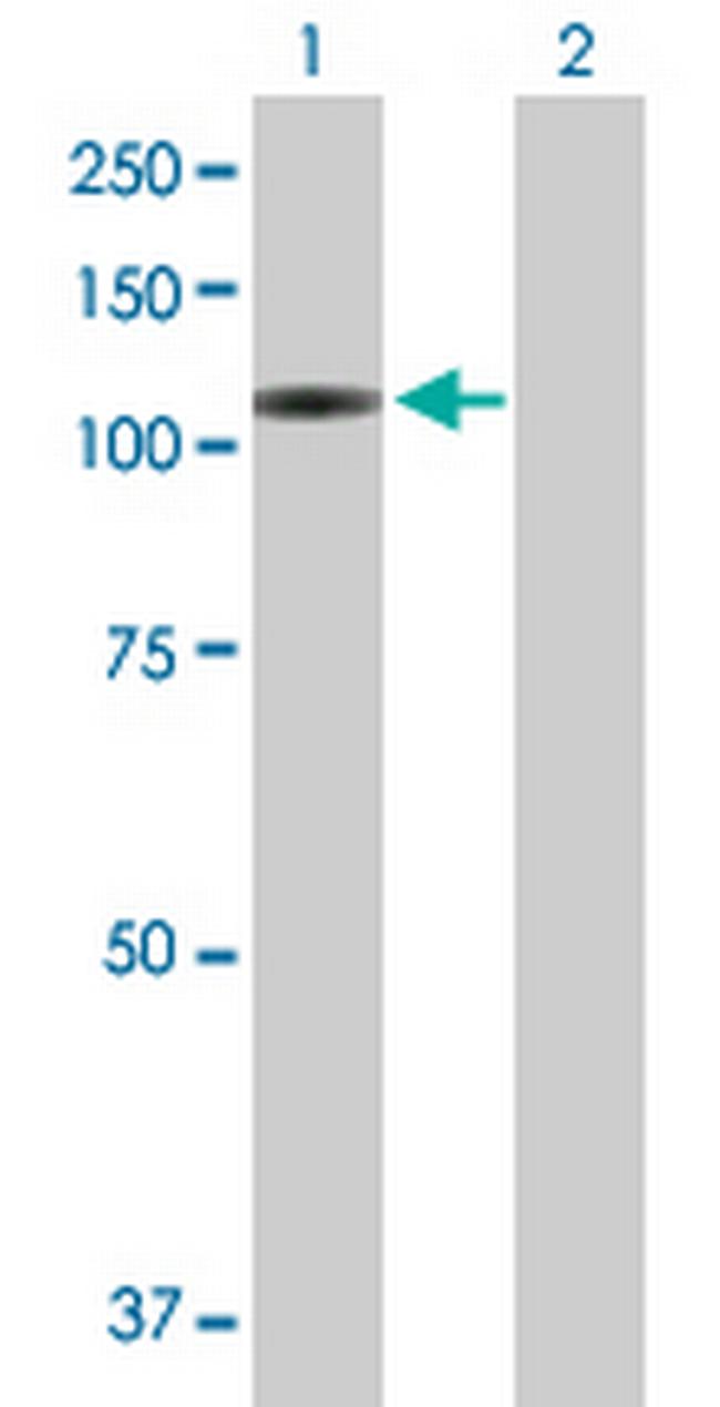 VPS54 Antibody in Western Blot (WB)