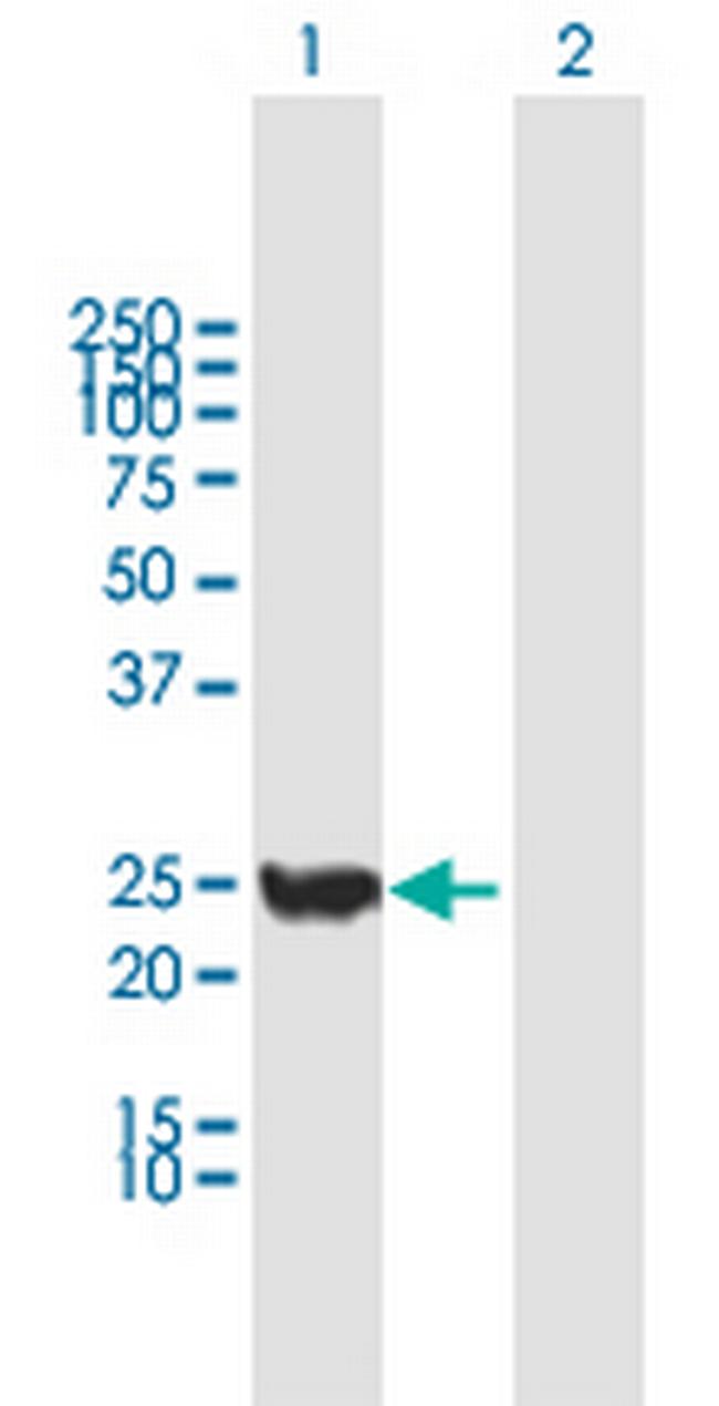 CINP Antibody in Western Blot (WB)
