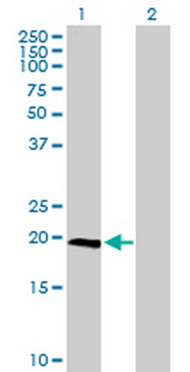 IL23A Antibody in Western Blot (WB)