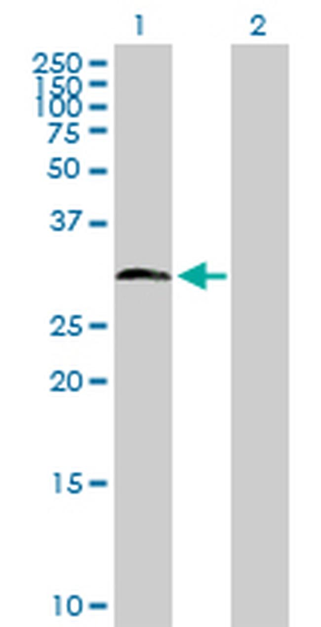 HDAC7A Antibody in Western Blot (WB)