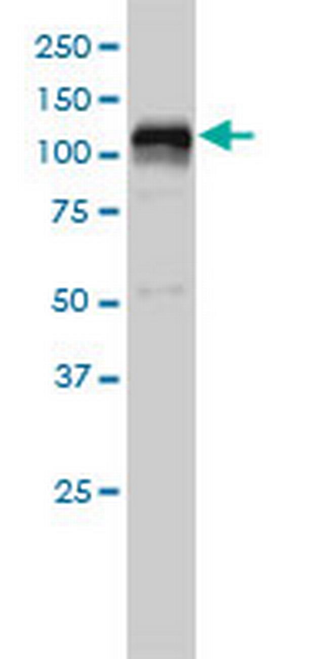 HDAC7A Antibody in Western Blot (WB)