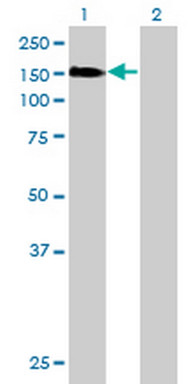 ESF1 Antibody in Western Blot (WB)