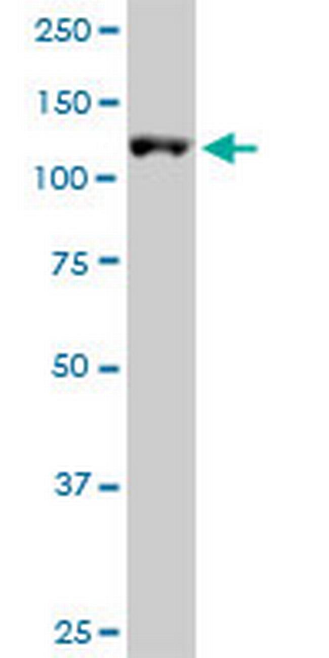 ARS2 Antibody in Western Blot (WB)