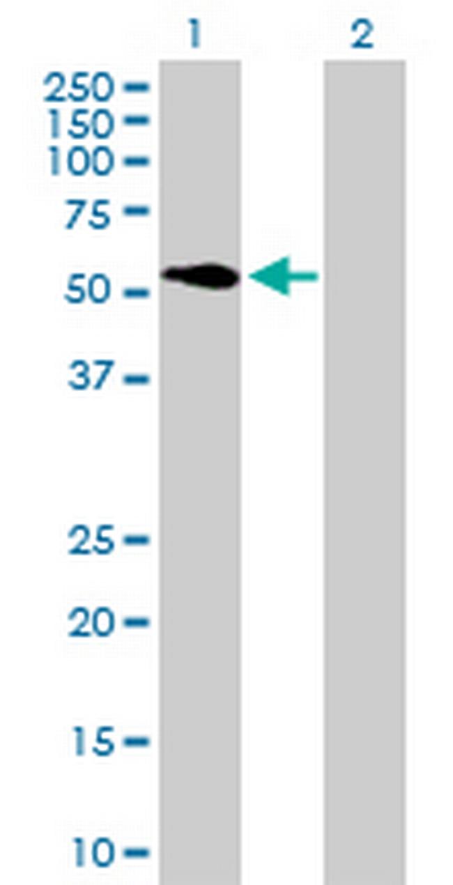 ATP6V1H Antibody in Western Blot (WB)