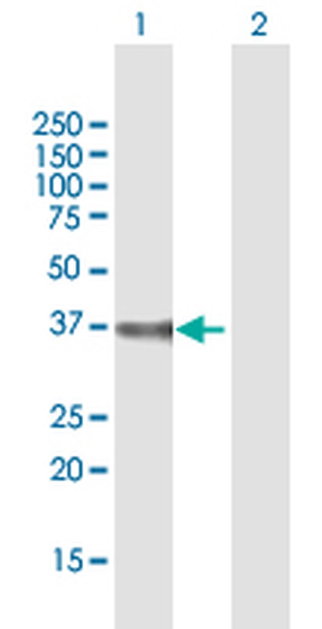 DPH5 Antibody in Western Blot (WB)
