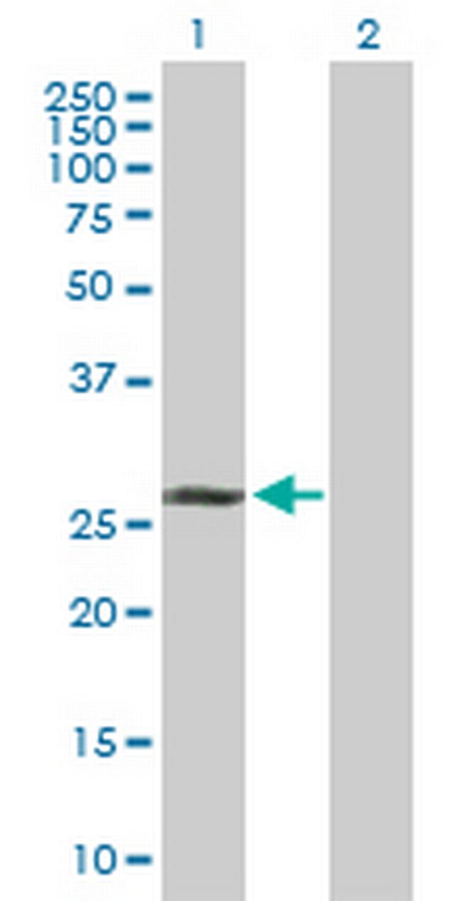 TAF9B Antibody in Western Blot (WB)