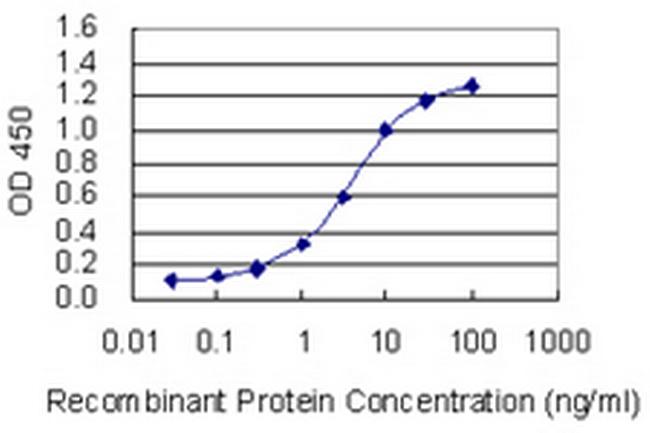 OTUD6B Antibody in ELISA (ELISA)