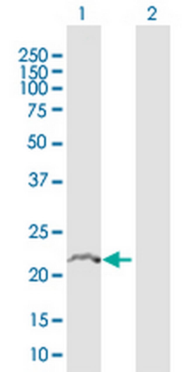 TMBIM4 Antibody in Western Blot (WB)