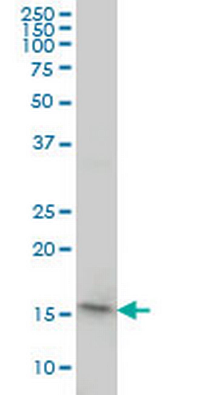 PPIL1 Antibody in Western Blot (WB)