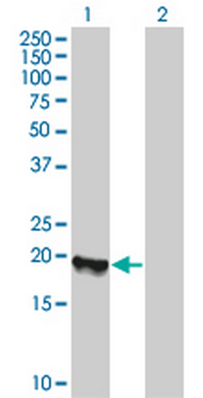 BIT1 Antibody in Western Blot (WB)