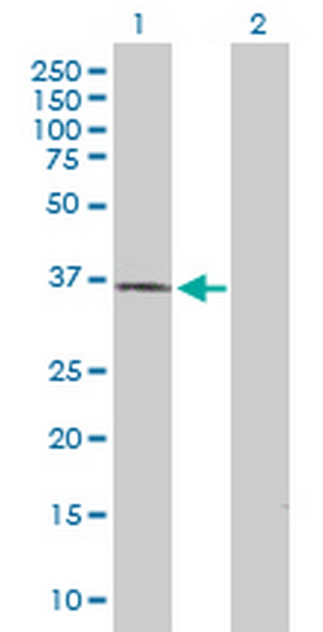 STYXL1 Antibody in Western Blot (WB)