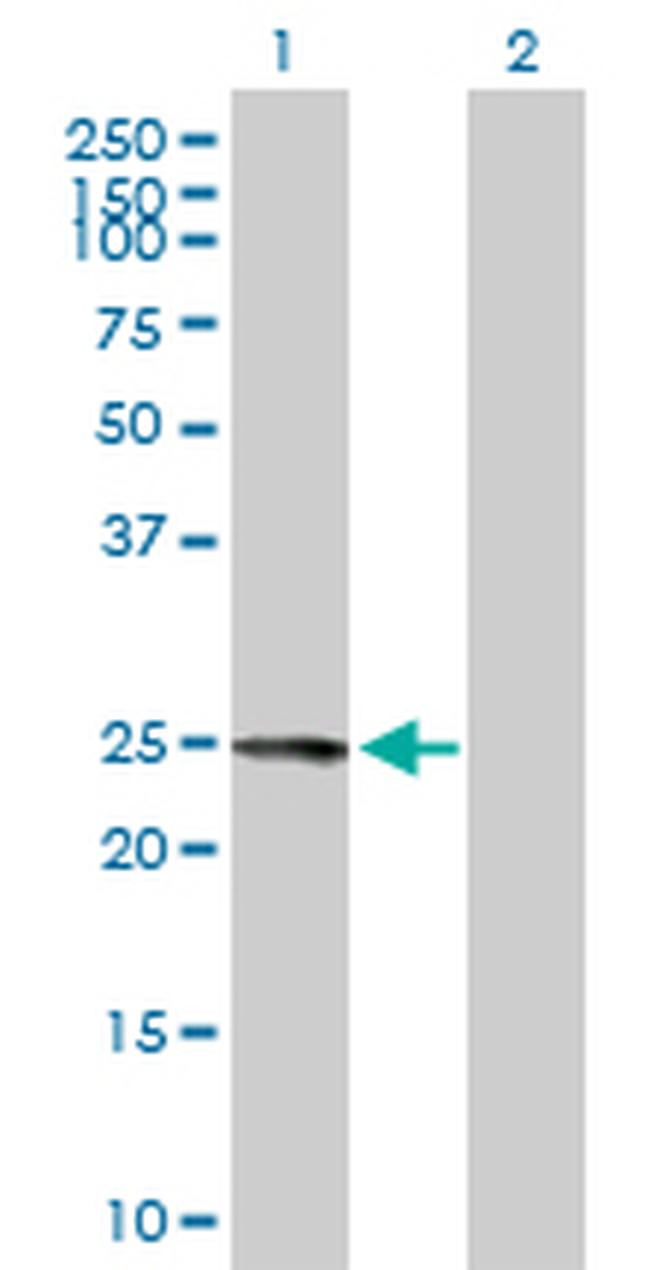 FKBP7 Antibody in Western Blot (WB)