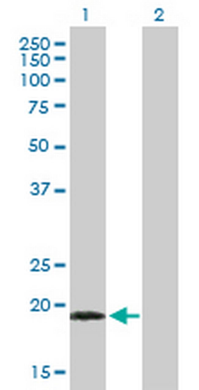 TPPP3 Antibody in Western Blot (WB)