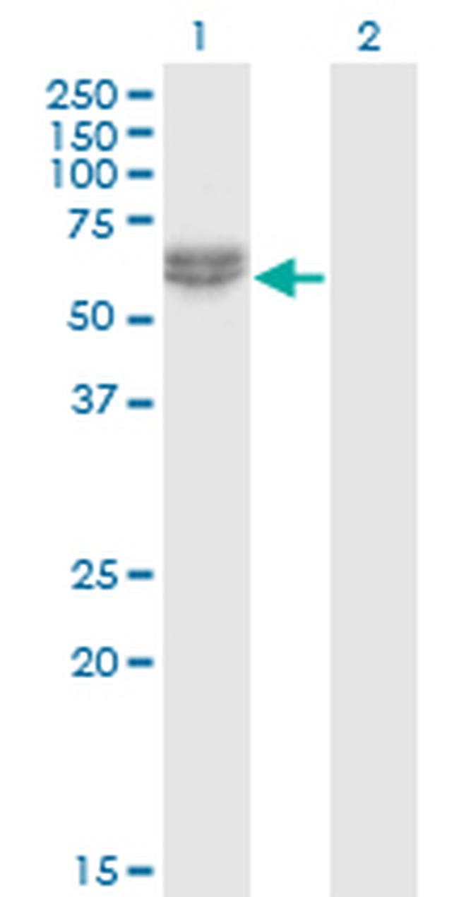 NLK Antibody in Western Blot (WB)